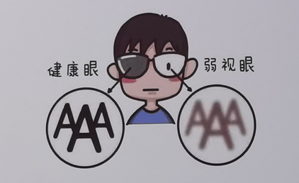 1分钟带你快速了解弱视以及预防