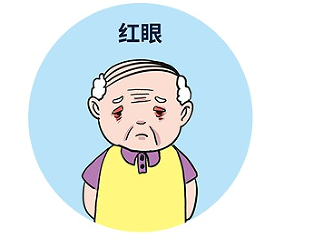 一种不可逆性致盲眼病——青光眼