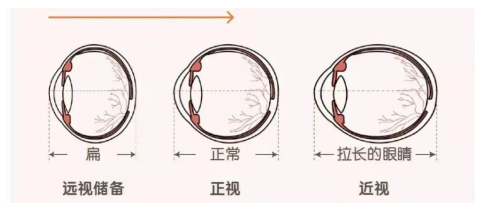 什么时候测眼轴？多久测一次？